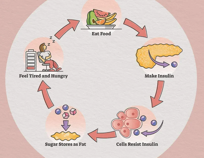 insulin-resistence